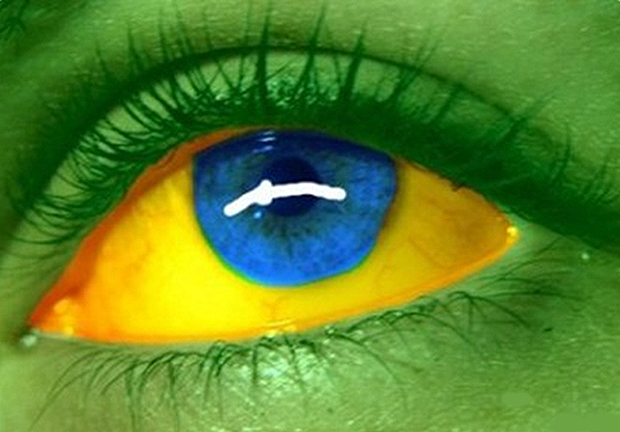 brasil