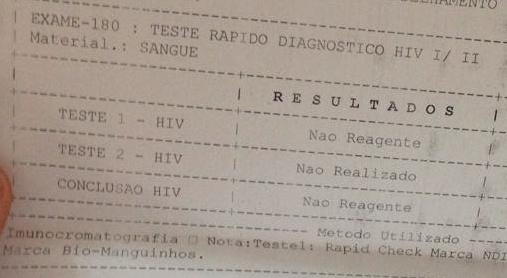 Jovem segura seu teste rápido de Aids: "deu negativo | Foto: Thiago Araújo