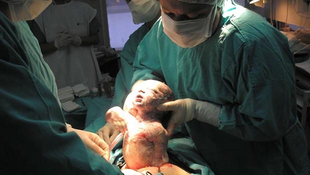 Foto: Astaffolani/ Wikimedia Common