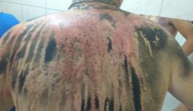 Calouro da Faculdade da Amazônia expõe a violência praticada por veteranos | Foto: Arquivo pessoal