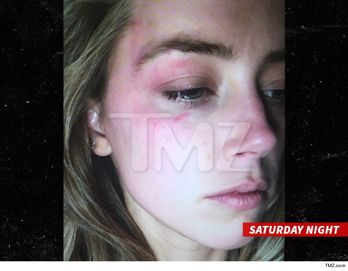 O site norte-americano TMZ divulgou imagens da atriz com hematomas no rosto após agressão | Foto: reprodução TMZ