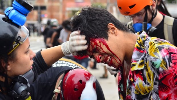 Jovem machucado após confronto com a PM durante protesto em São Paulo. Imagens assim têm se tornado cada vez mais comum em todo o país | Foto: Rovena Rosa