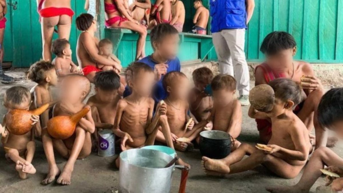 Crianças Yanomamis desnutridas em Roraima | Foto: Agência Brasil