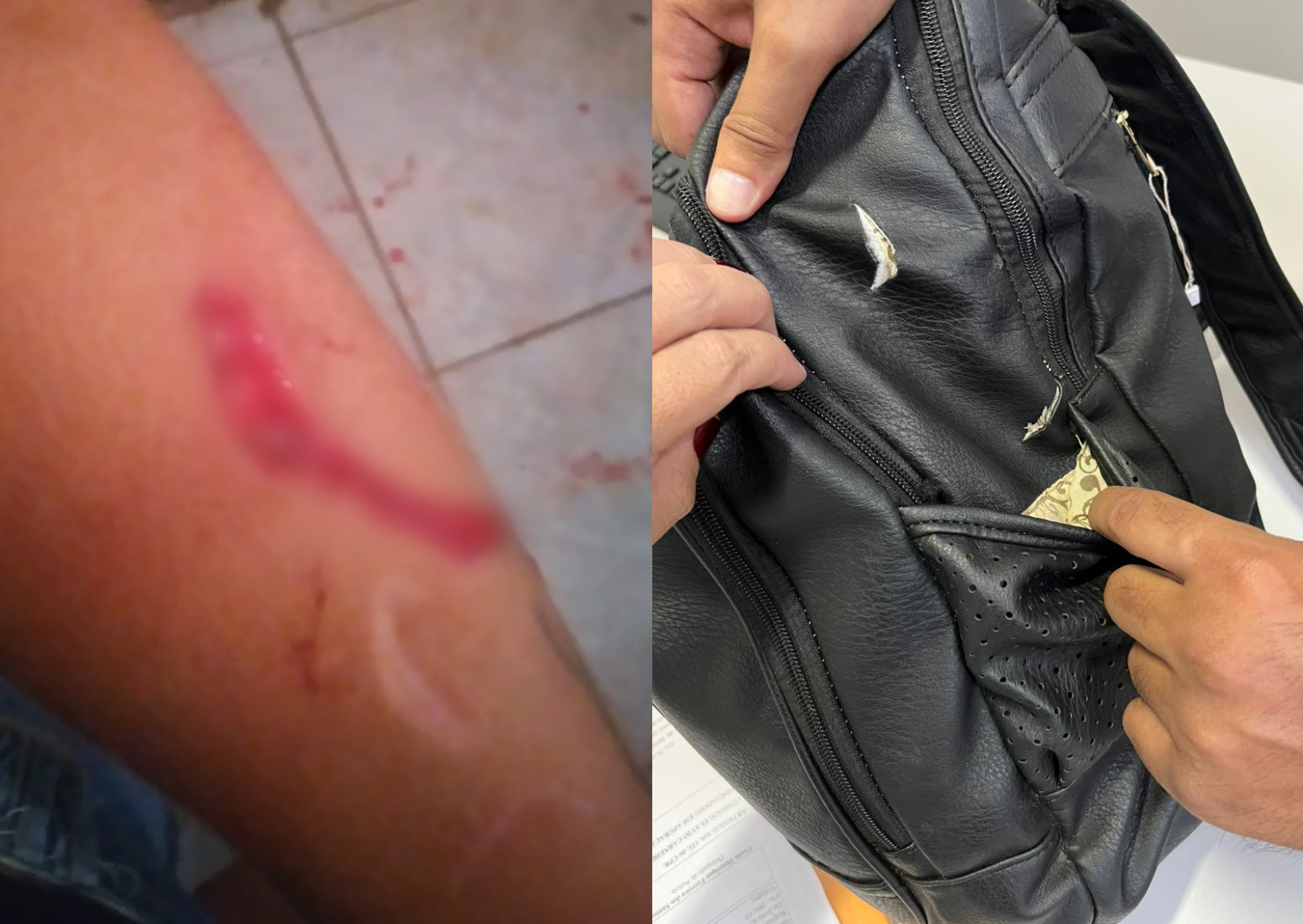 Mulher mostra braço e bolsa com sinais de golpes de faca | Foto: PC-GO