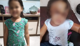 Menina ficou irreconhecível após agressões | Foto: divulgação