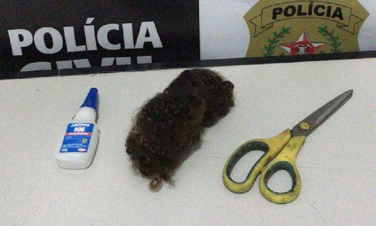 Vítima contou que levou socos e chutes | Foto: PC