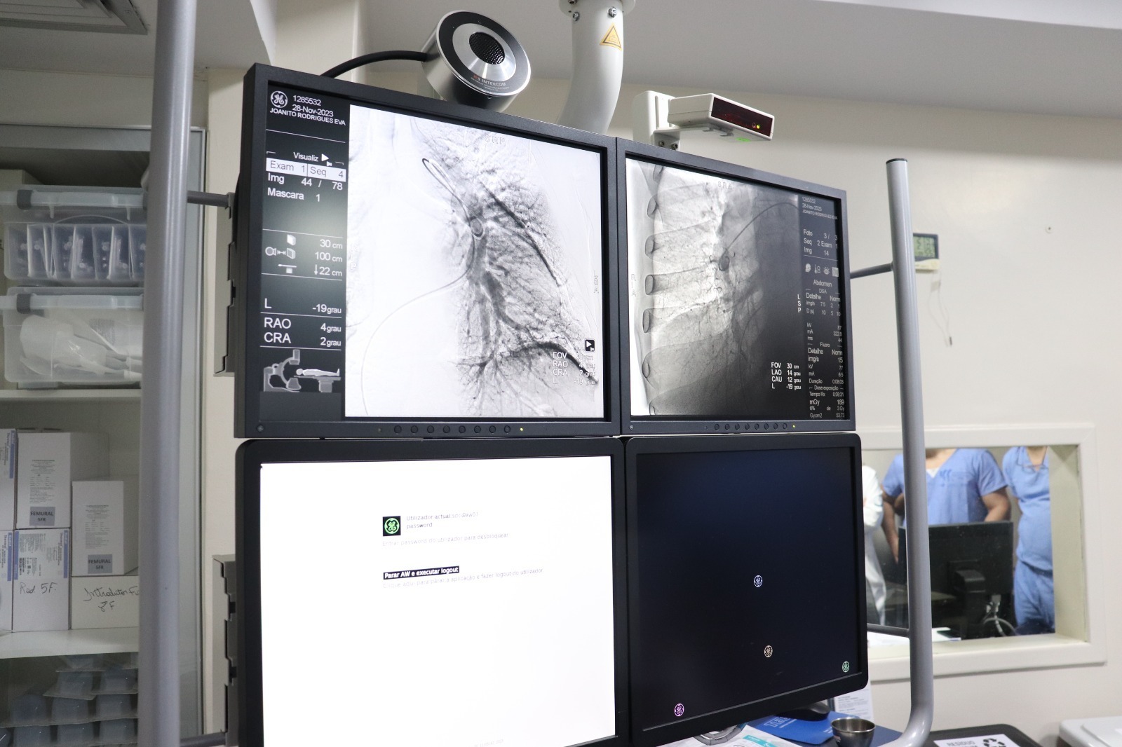 HGG angioplastia pulmonar