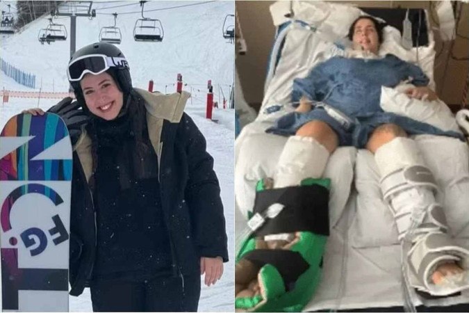 Brasileira Claudia com botulismo | Foto: divulgação/redes sociais
