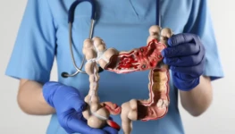 Cancer-de-intestino-960x720-1