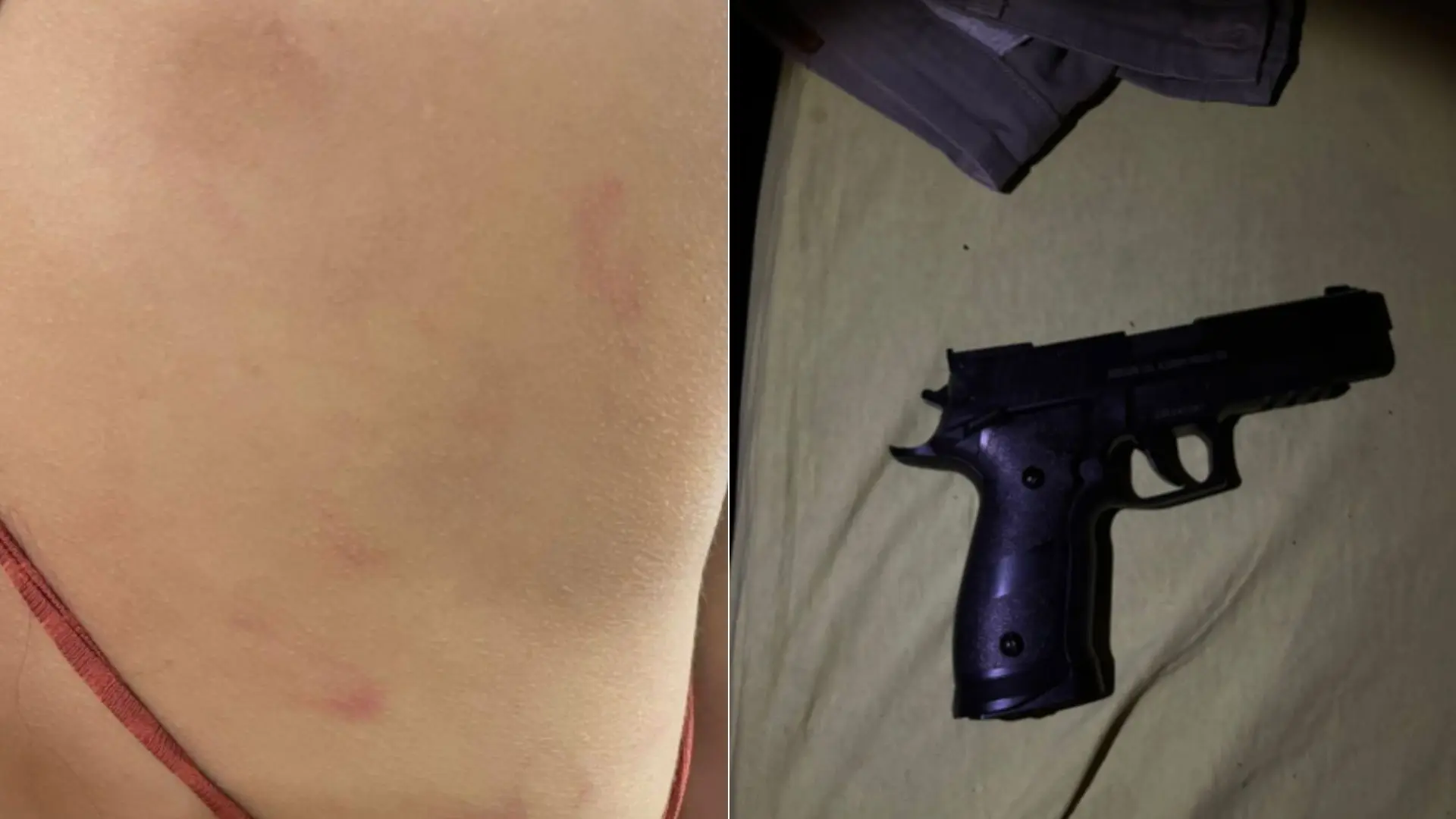 Machucados provocados pelo cunhado em adolescente de 15 anos | Foto: PC-GO