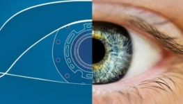 Cornea Israel