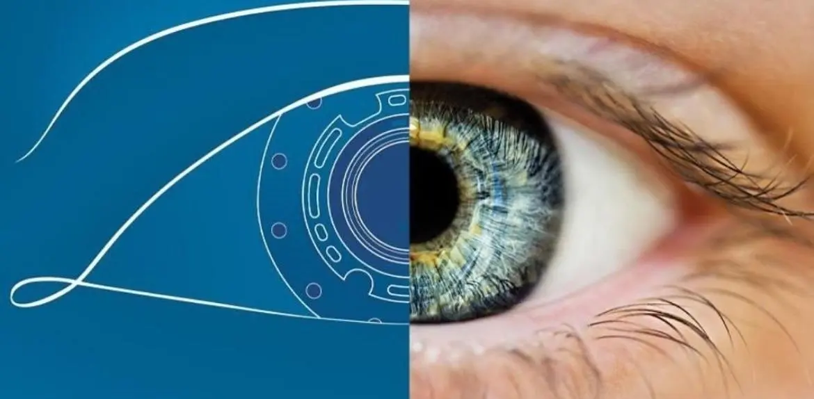 Cornea Israel