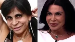 medico-mostra-o-antes-e-depois-de-gretchen-apos-procedimentos-esteticos-1759586691780_v2_900x506-jpg