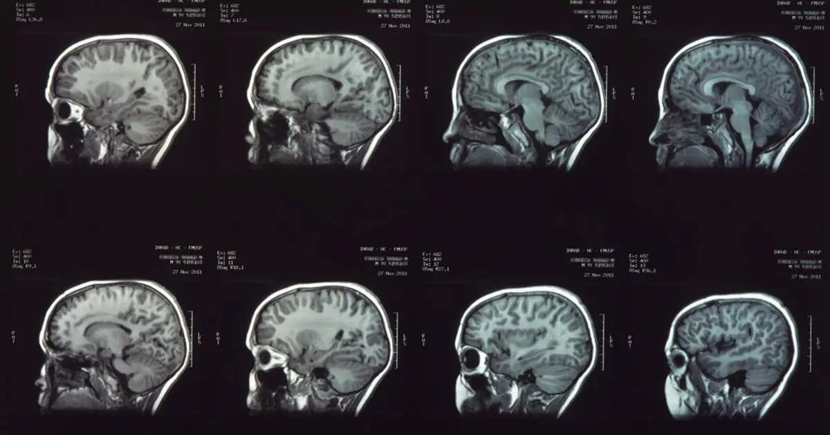 8bdd63f506c7dc6ede6d737161b27c524a0324d0_1200-630