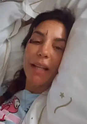 ivete-sangalo-olho-roxo