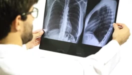 1776340178-08abr2020_raiox_raquelaviani