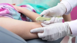 Implantes-hormonais