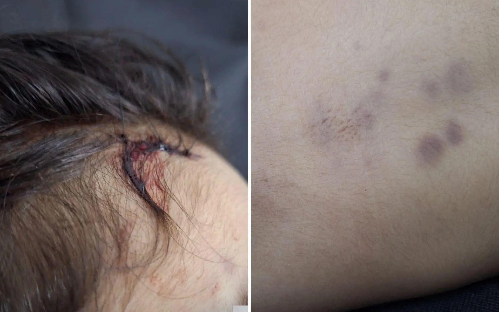 Criança de 2 anos morre com sinais de agressão em Aparecida de Goiânia; pai e babá são presos suspeitos do crime