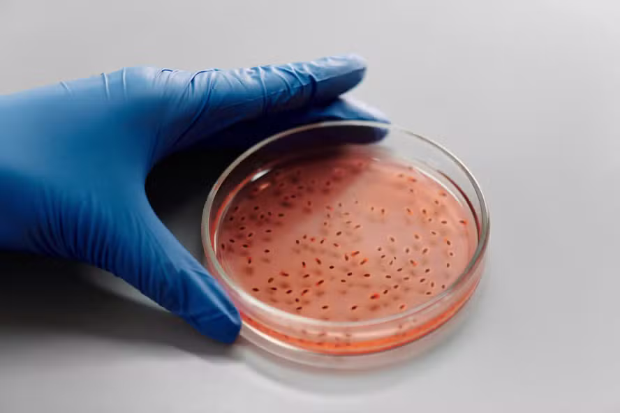 Descoberta sobre bactéria encontrada em produtos da Ypê pode ajudar no combate a infecções resistentes