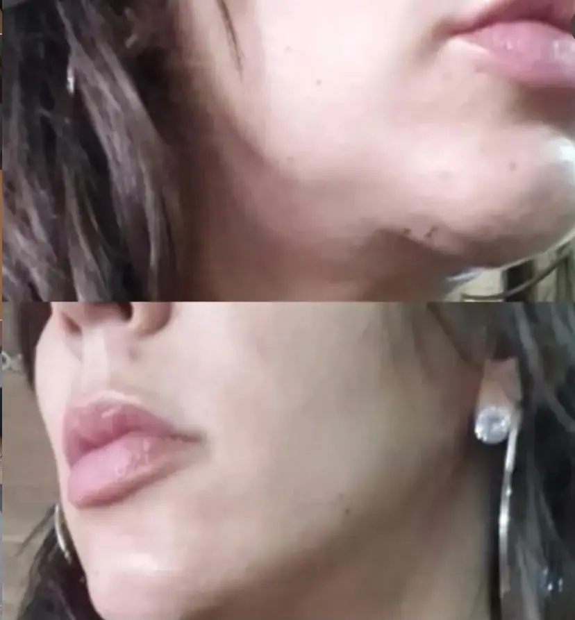 “Ela usava o nome de Deus”: vítimas relatam sequelas, ameaças e suspeitas contra dentista presa em Goiânia