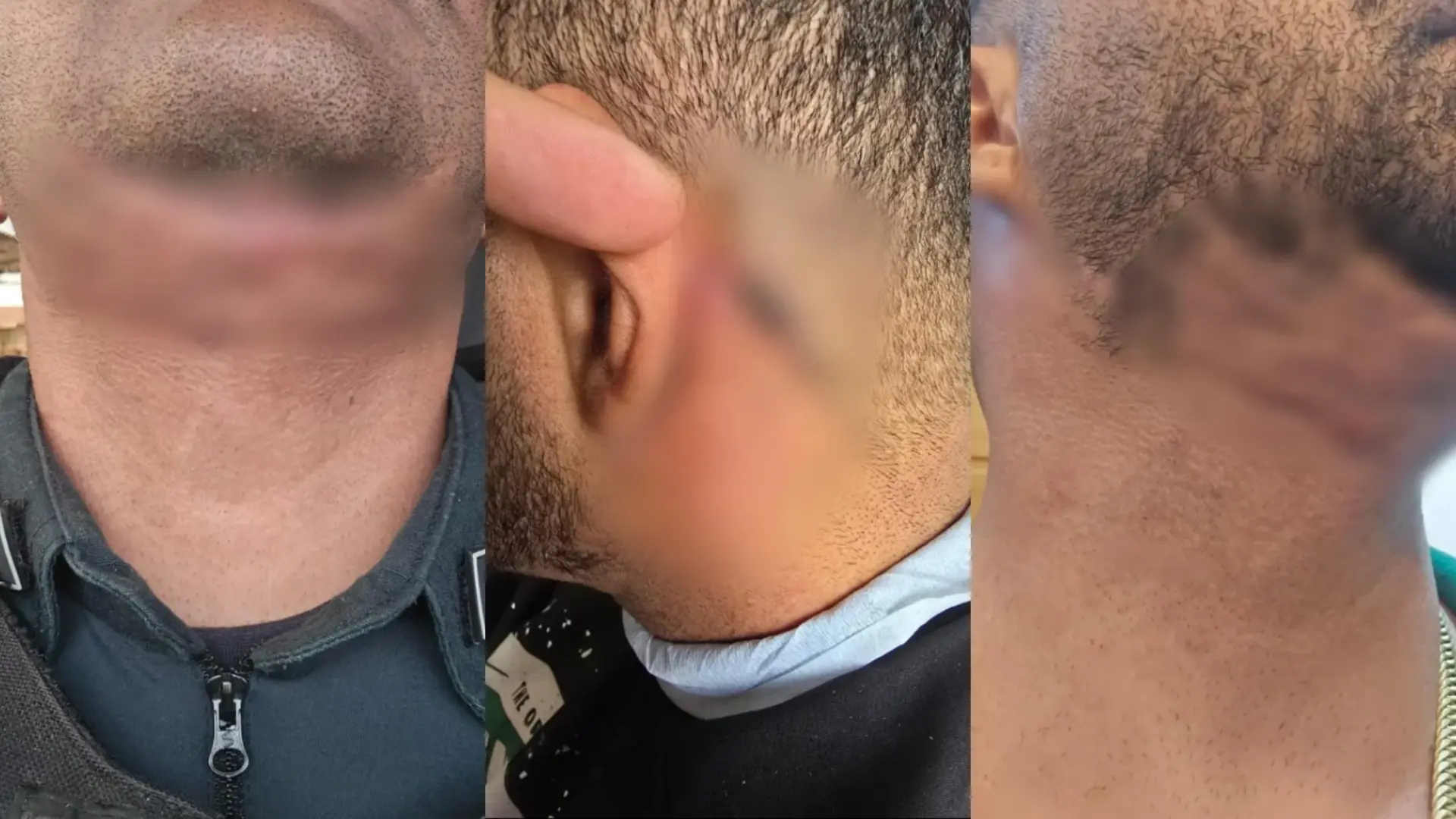 Grupo de vítimas de dentista investigada reúne 18 pacientes; entenda os relatos e veja as sequelas